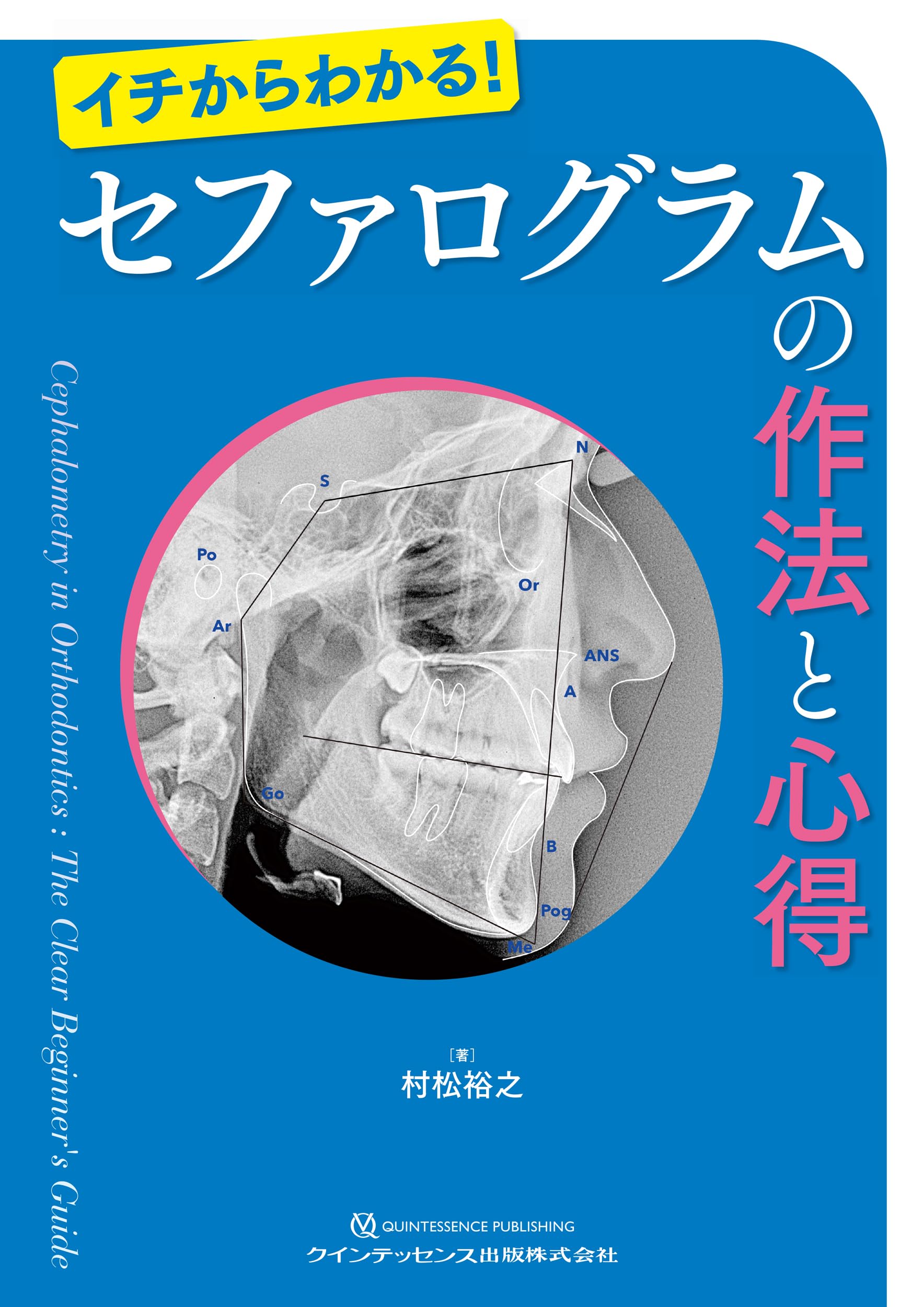 セファログラムの作法と心得: イチからわかる! | 村松裕之 |本 | 通販